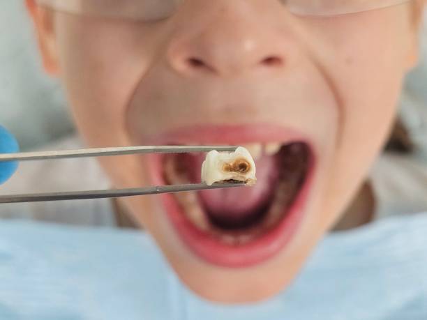 Best Pediatric Emergency Dentist in Wrightsboro, NC