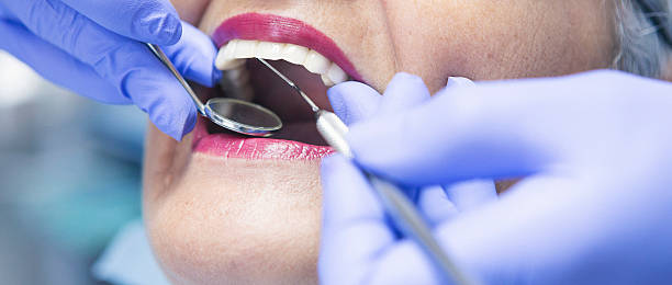 Best Emergency Tooth Extraction in Wrightsboro, NC